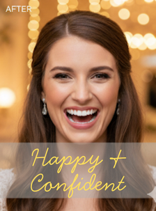 teeth whitening before wedding at bright Smile Dental Clinic